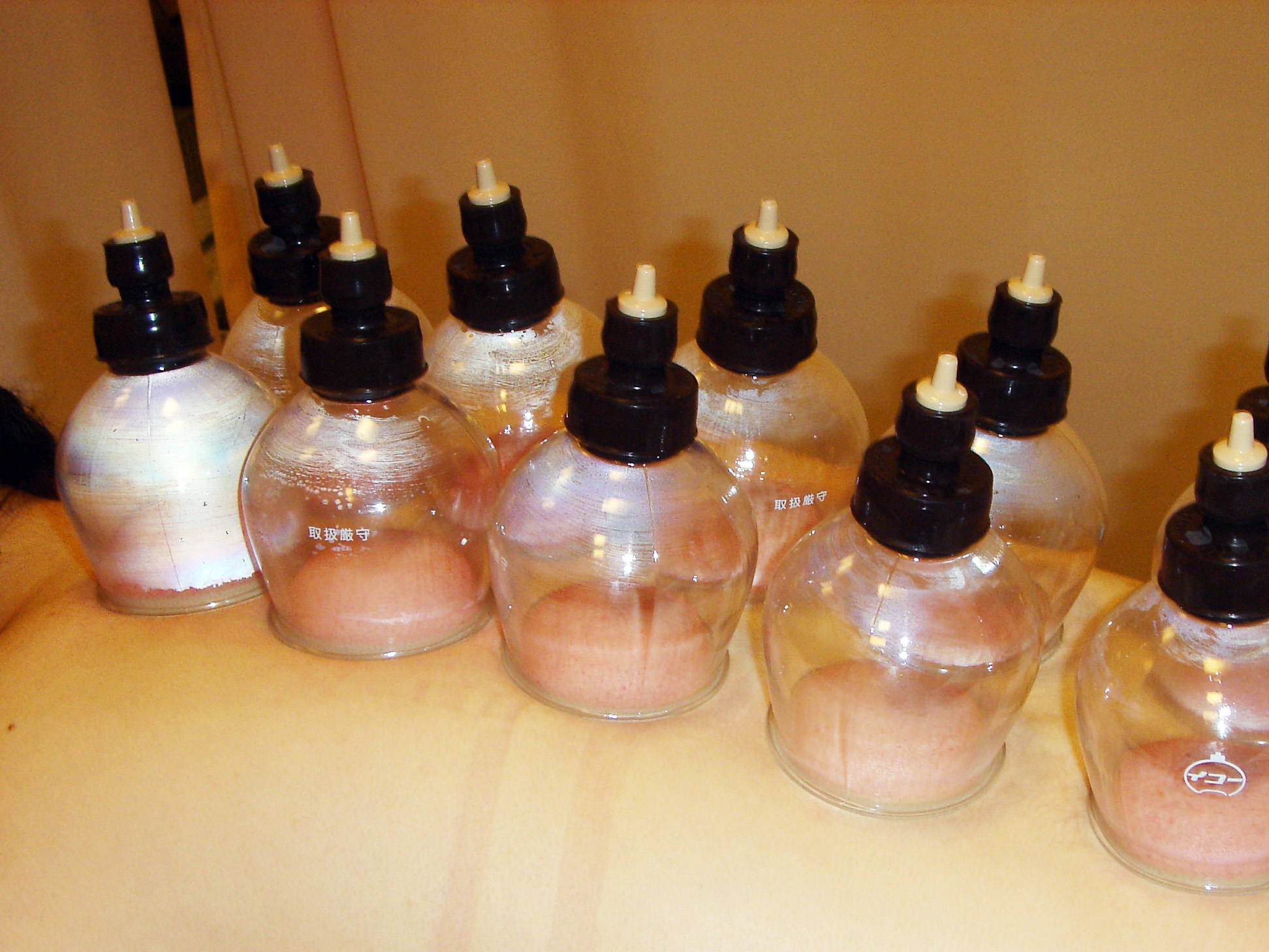 Cupping & Shiatsu