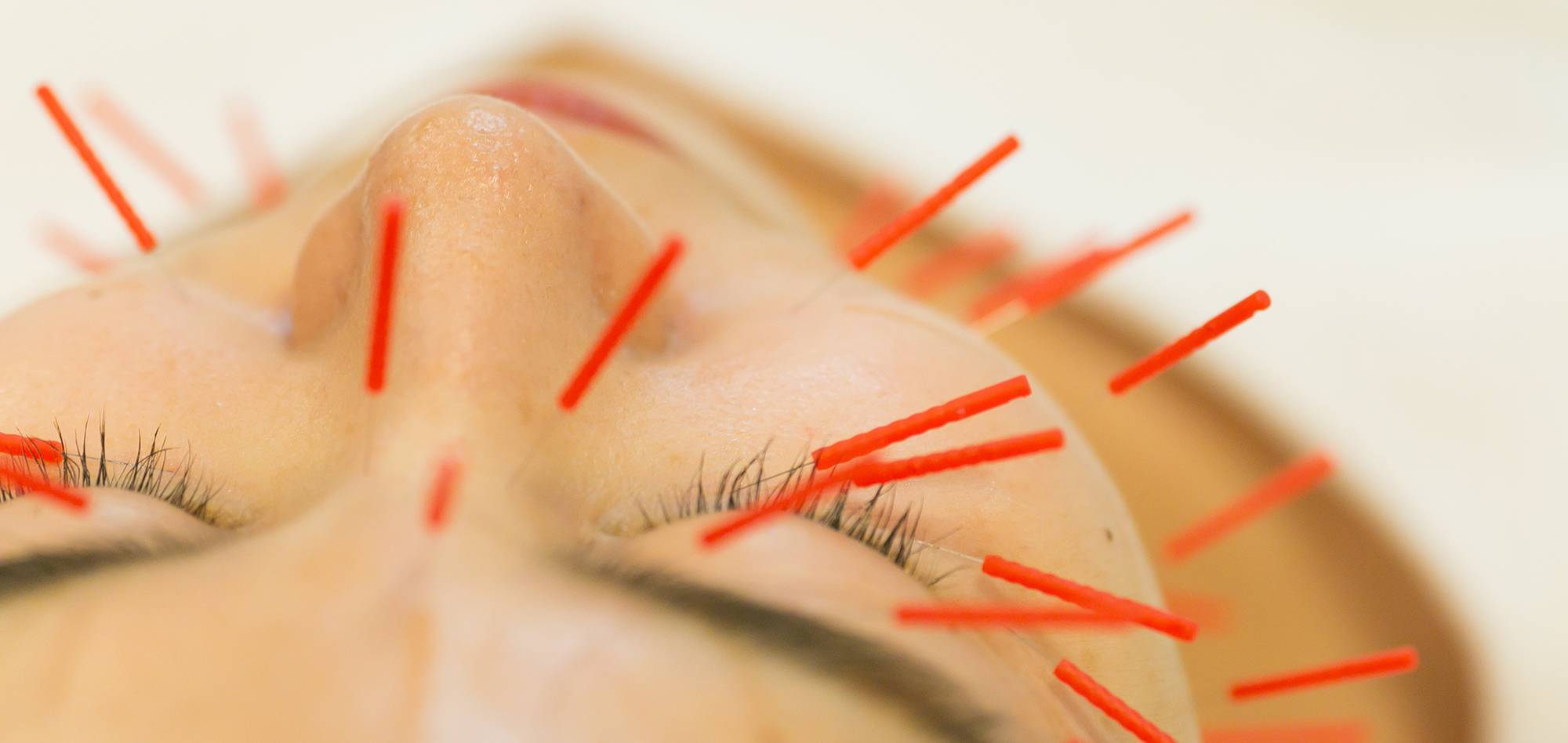 Facial Acupuncture