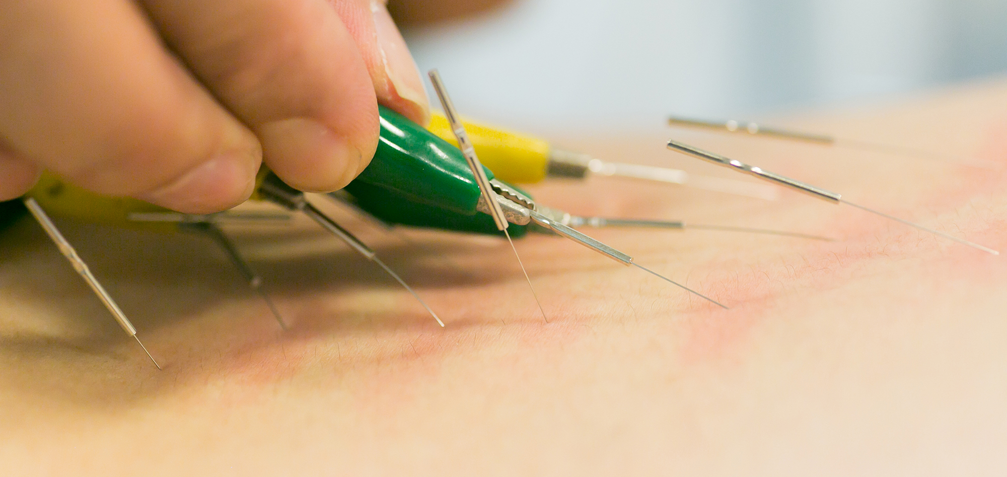 Acupuncture & Shiatsu