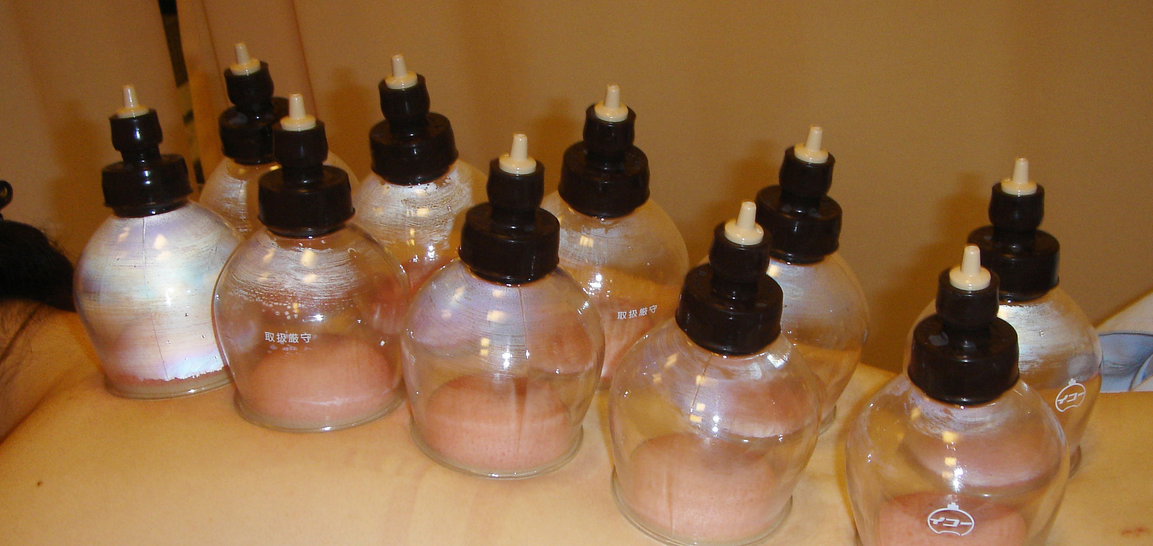 Cupping & Shiatsu