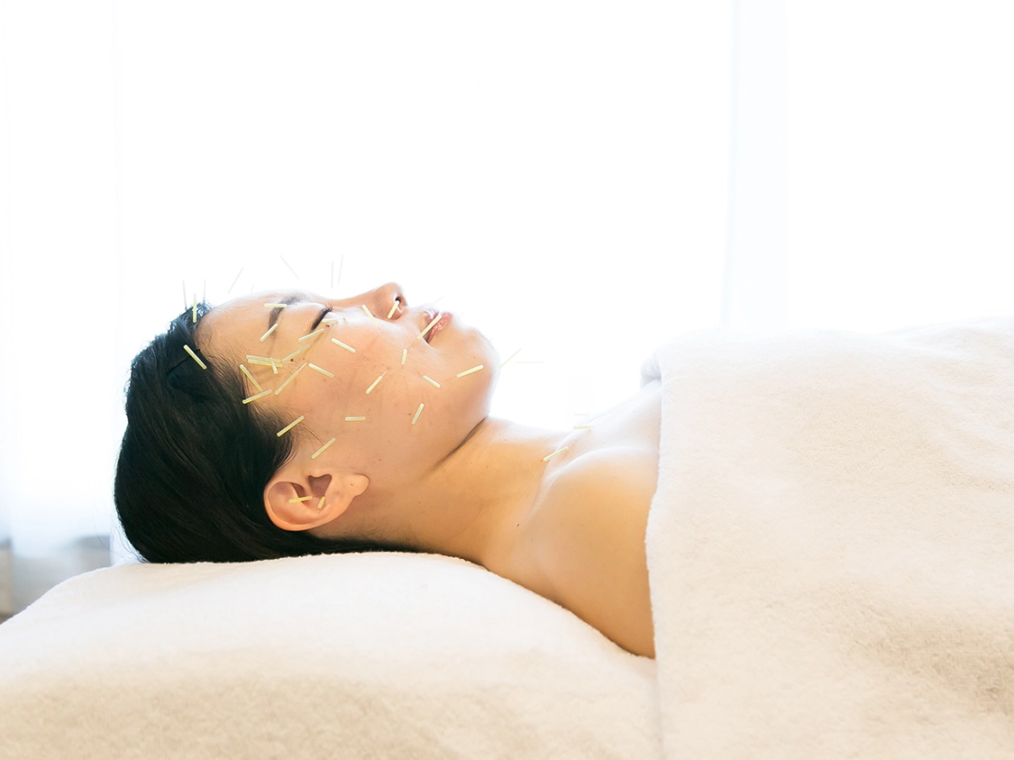 Facial Acupuncture
